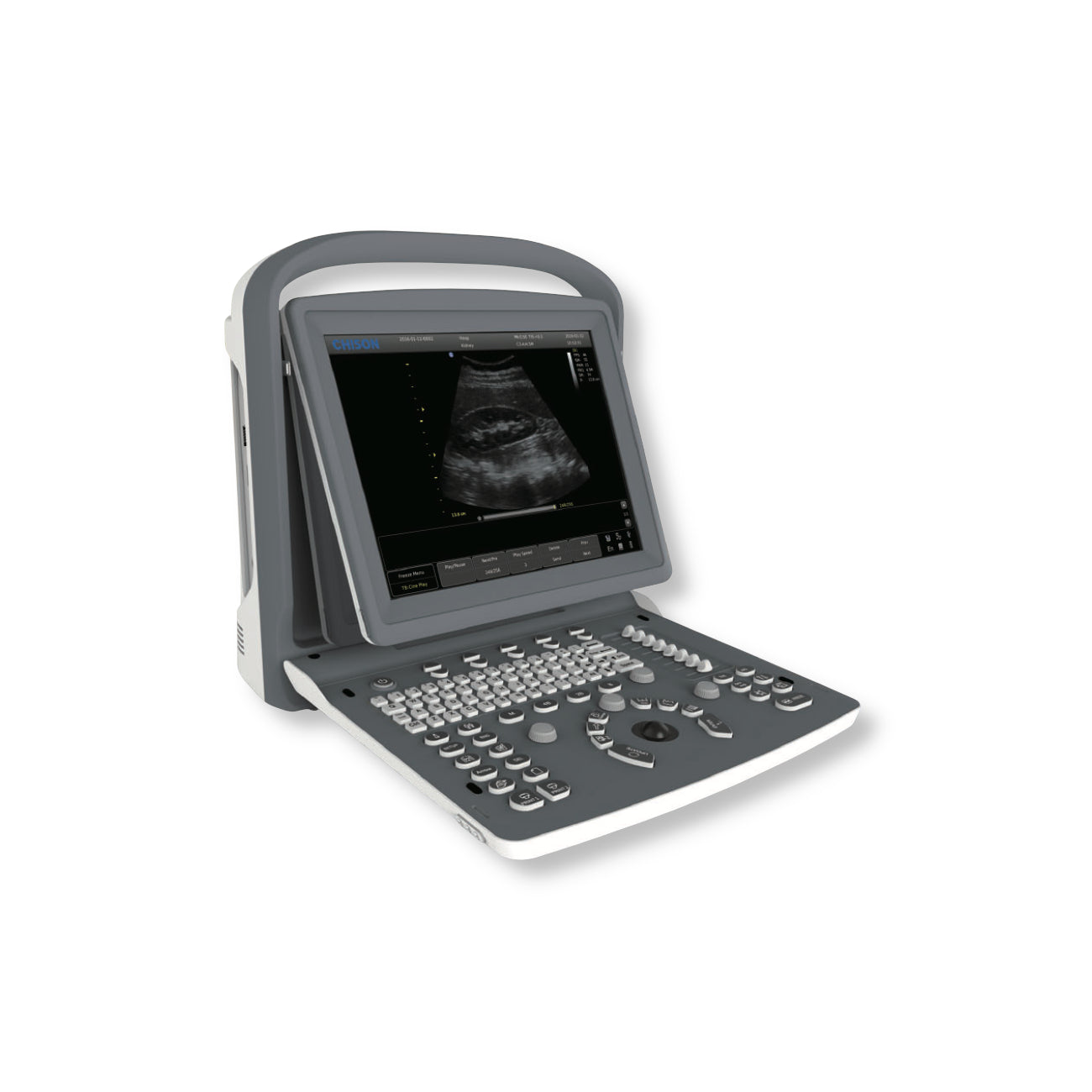 Chison ECO2 VET Ultrasound #