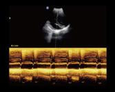 Chison ECO2 VET Ultrasound #