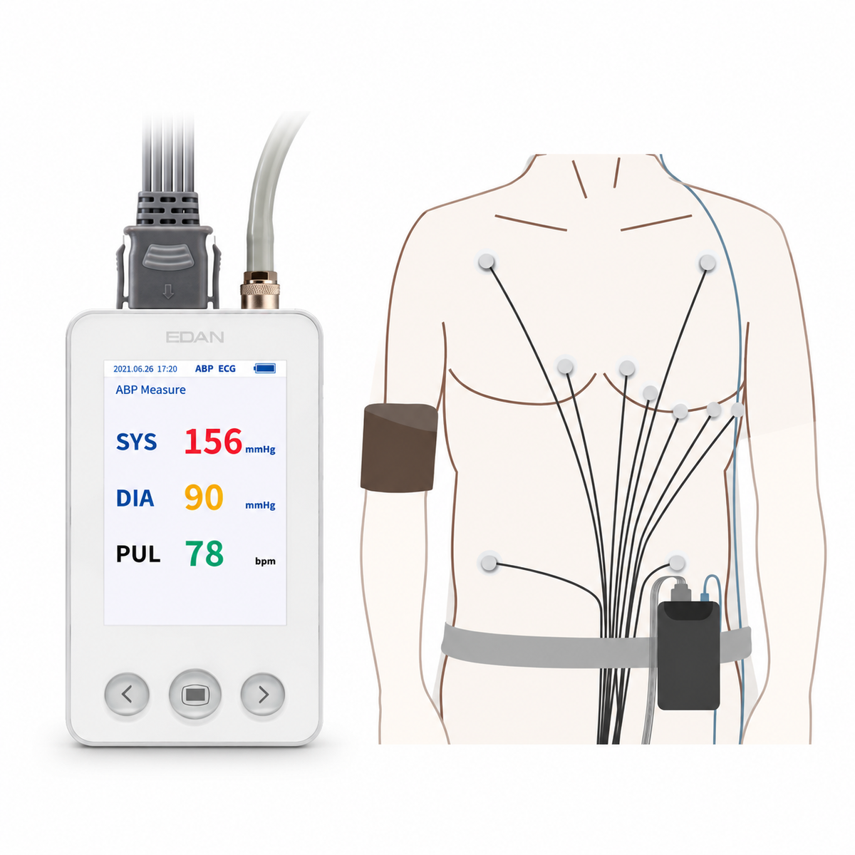 EDAN SA-20 2-in-1 Holter ECG and ambulatory blood pressure recorder with 3/12-lead pacemaker detection and up to 48-hour recording for combined cardiac and BP monitoring