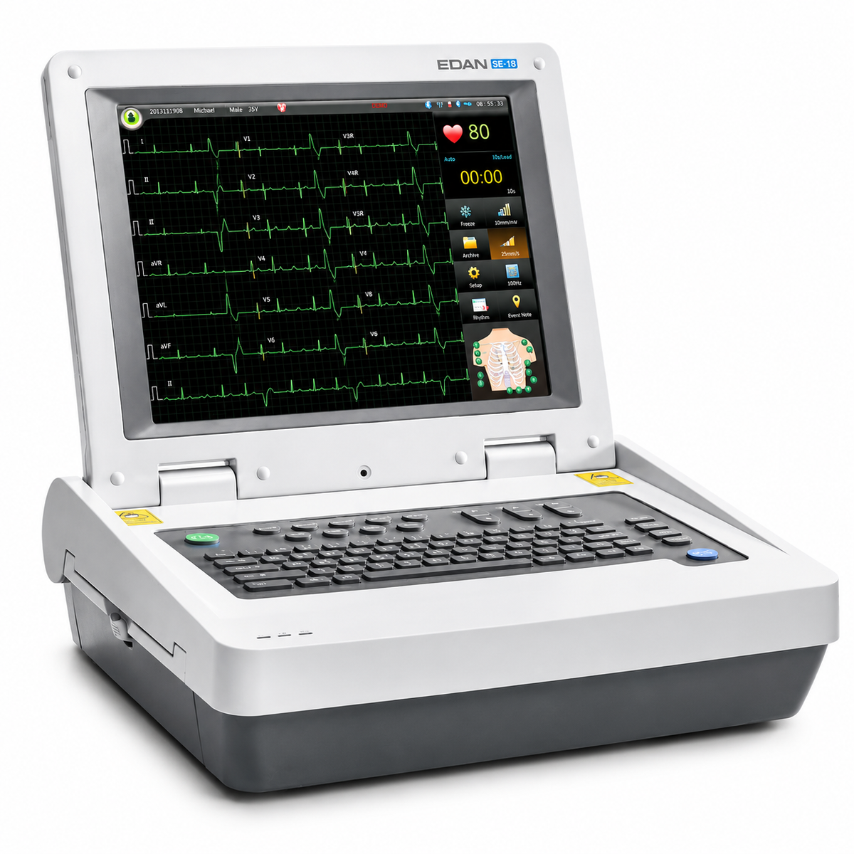 EDAN SE-18 18-lead professional ECG workstation with 15-inch touchscreen, DE18 sampling box, 64,000 Hz sampling and advanced VCG/TVCG/SAECG analysis for cardiac diagnosis