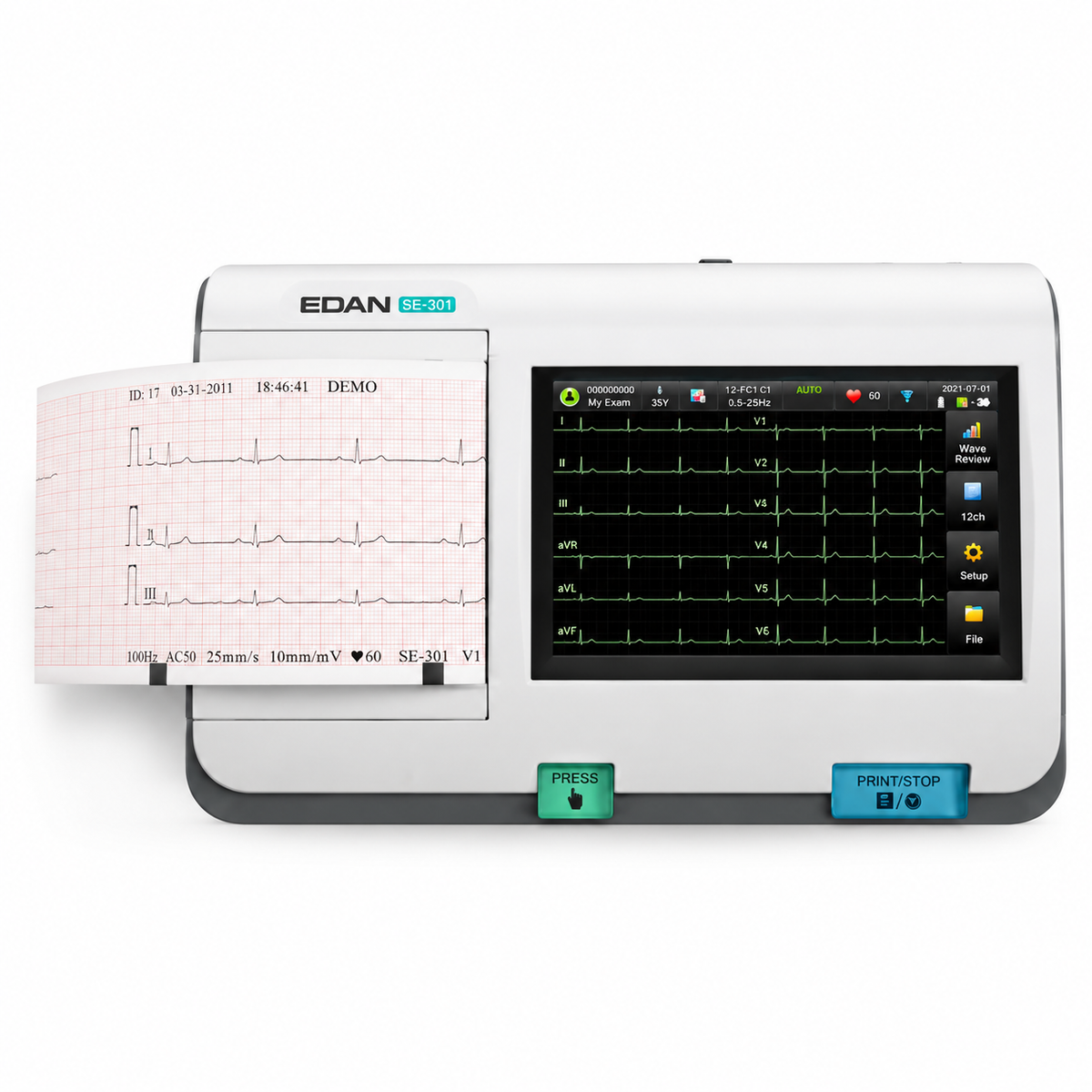 EDAN SE-301 3-channel portable electrocardiograph with 5-inch color touchscreen, 12-lead simultaneous acquisition, 24-bit A/D and built-in thermal printer for ward rounds and mobile ECG