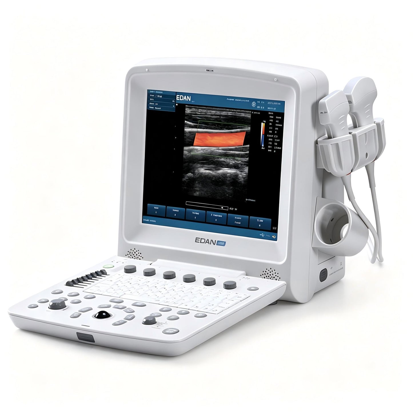 EDAN U50 portable diagnostic ultrasound system with 12.1-inch display and color Doppler imaging