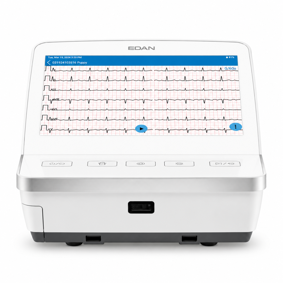 EDAN VE-1201 Pro 10.1-inch touchscreen 12-channel veterinary electrocardiograph with VE-SEMIP analysis algorithm, built-in Wi-Fi and thermal printer for animal cardiac assessment