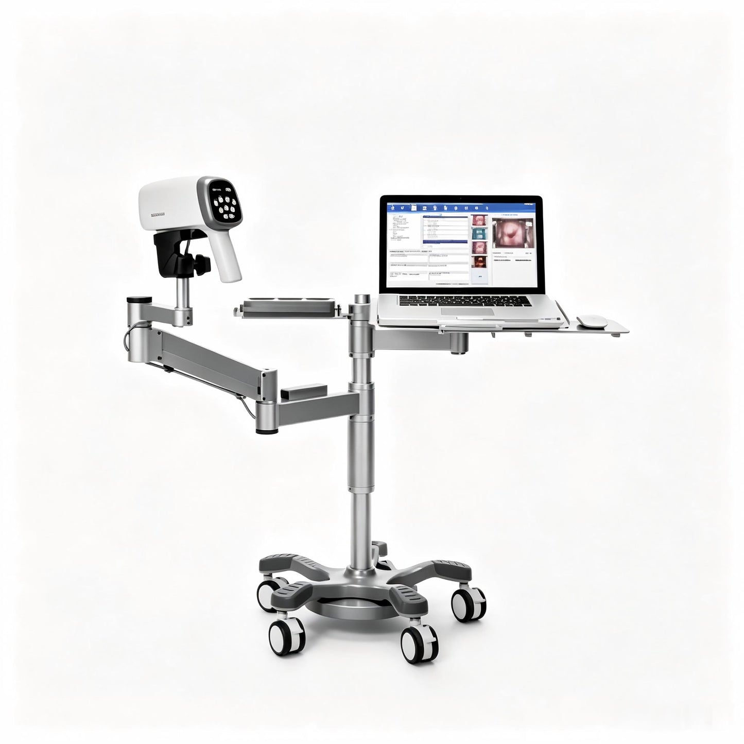 EDAN C3A Video Colposcope