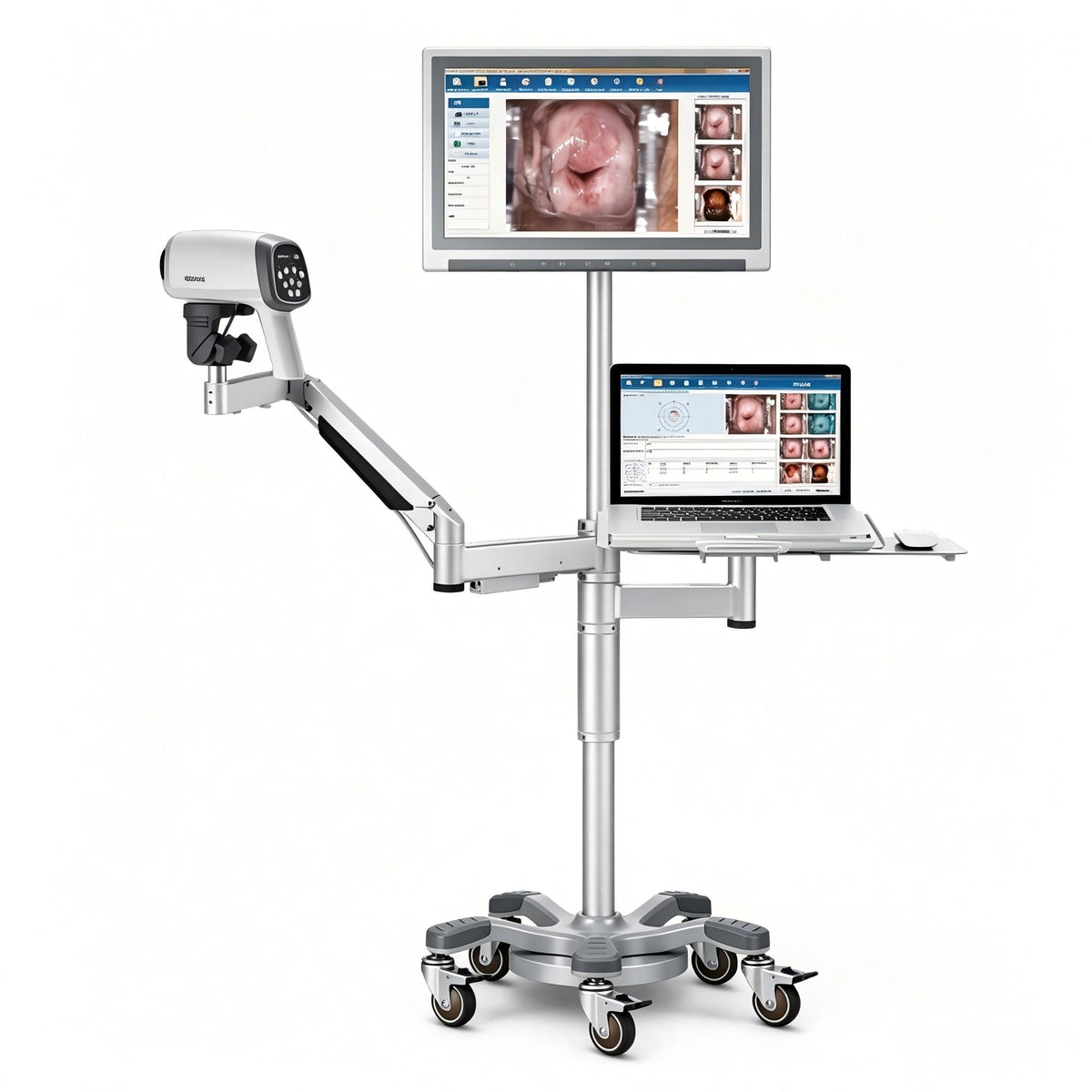 EDAN C6A Video Colposcope