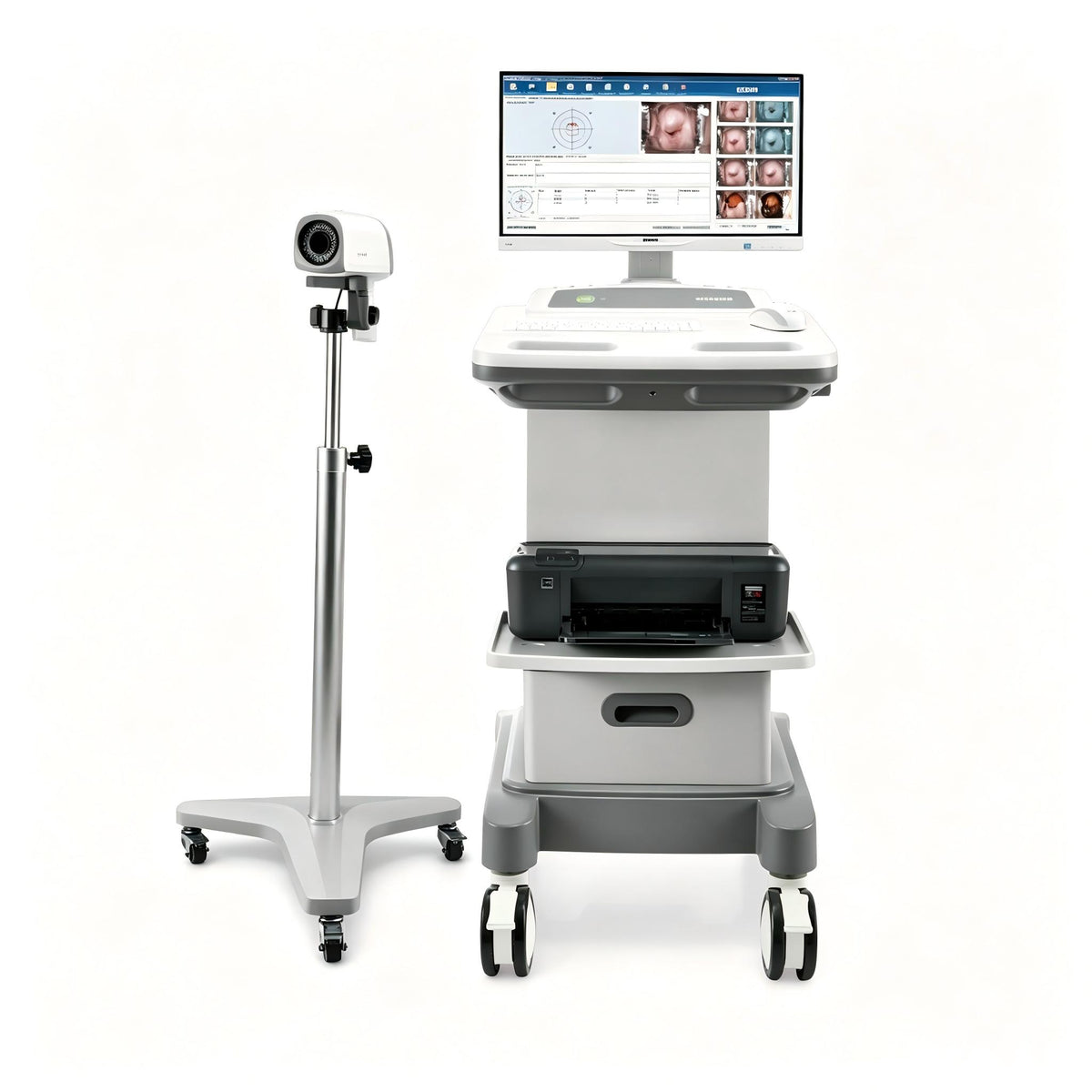 EDAN C6 video colposcope with LED lighting and high-resolution camera for cervical examination