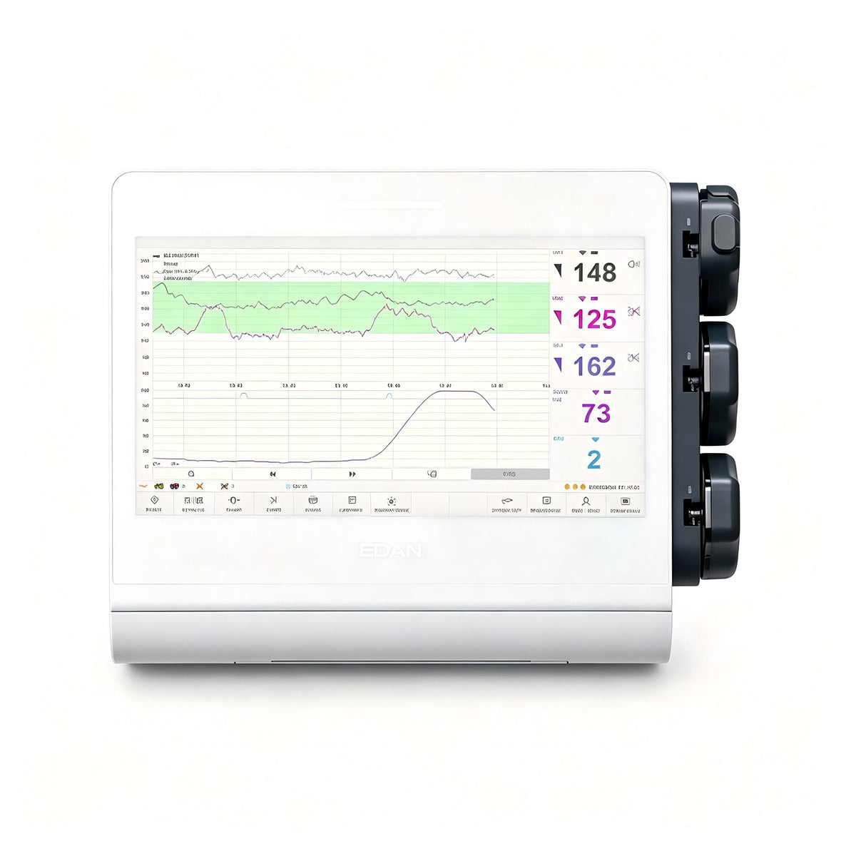 EDAN F12 Air wireless fetal and maternal monitor with 13.3-inch touchscreen for obstetrical monitoring