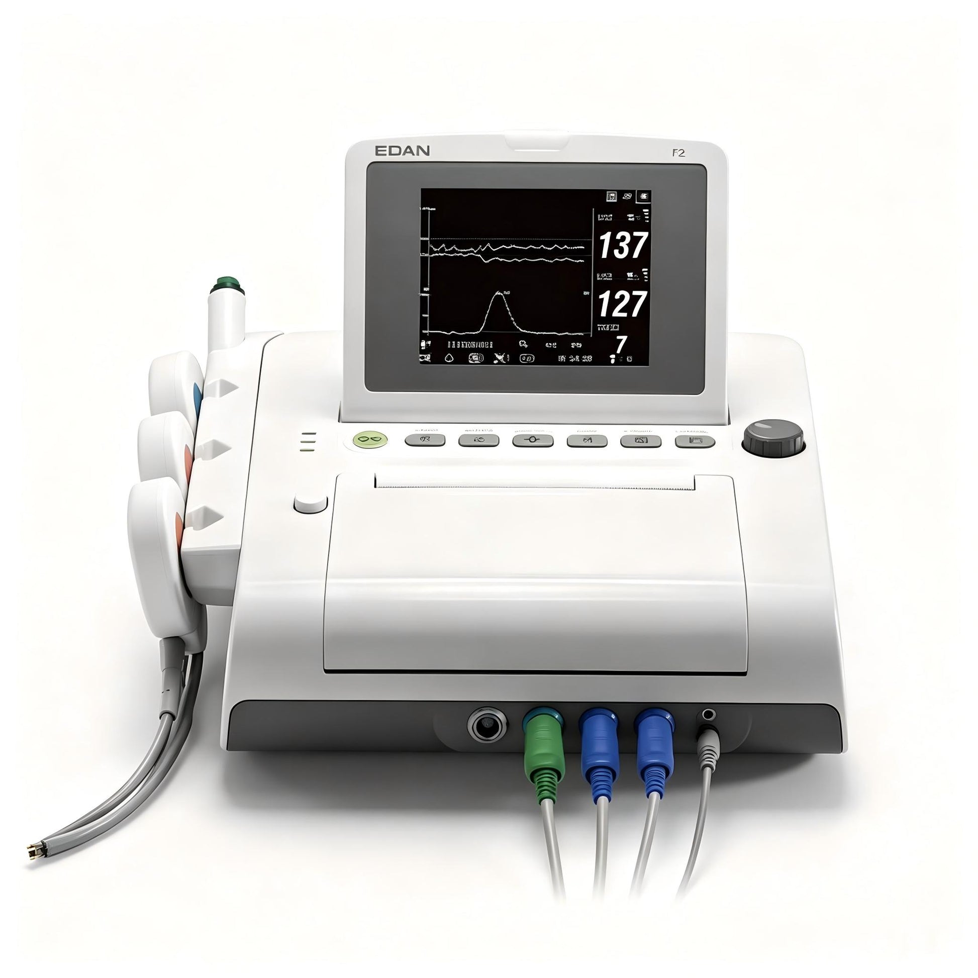 EDAN F2 fetal monitor with 5.6-inch foldable screen and thermal printer for obstetrical monitoring