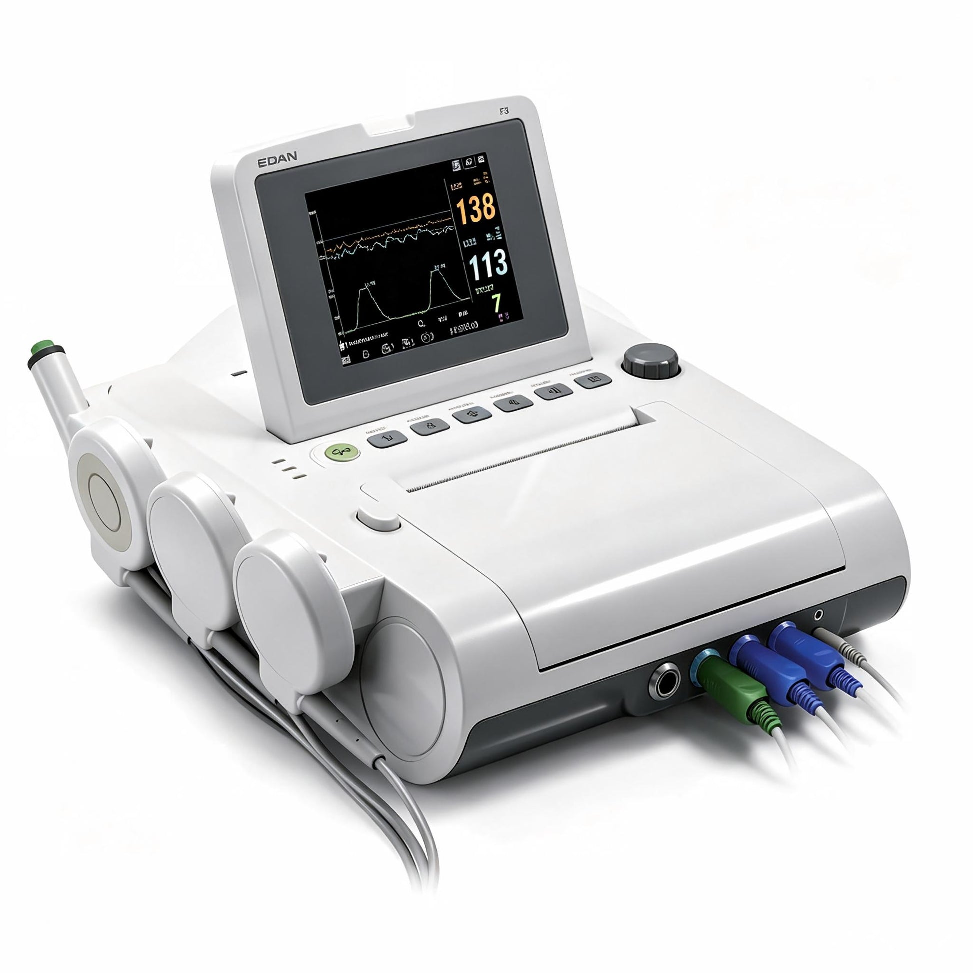 EDAN F3 fetal monitor with 5.6-inch foldable color screen and thermal printer for obstetrical monitoring