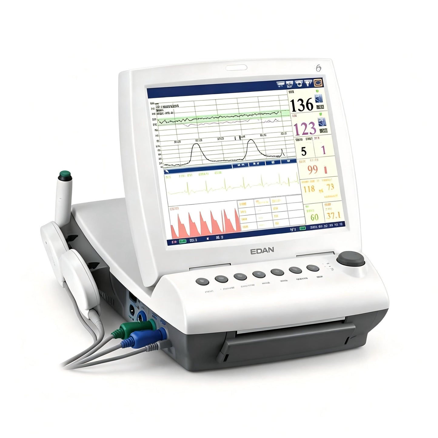 EDAN F9 fetal and maternal monitor with 12.1-inch touchscreen for obstetrical monitoring