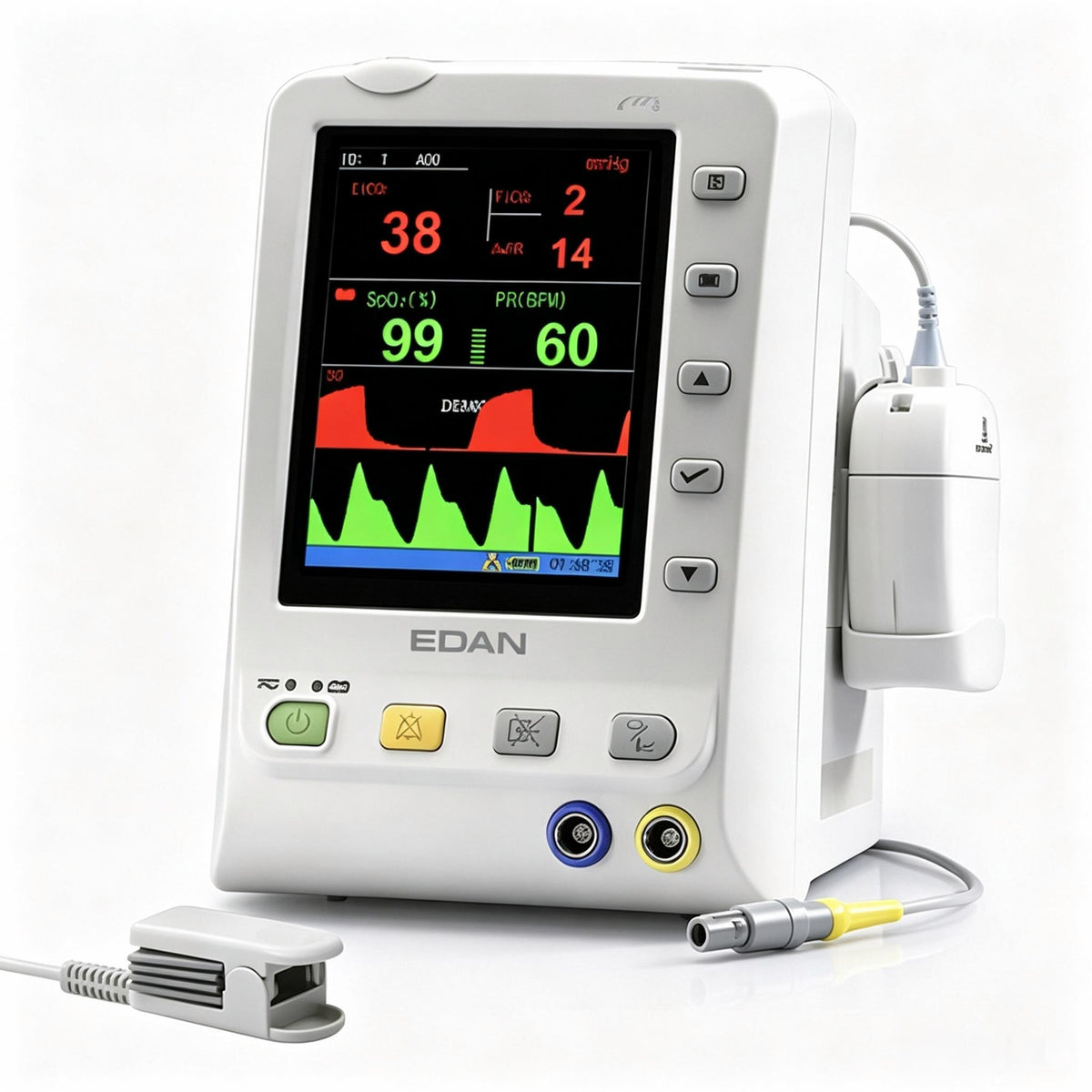 EDAN M3B capnograph monitor with 5.7-inch color display for SpO2, pulse rate, and Respironics CO2 monitoring