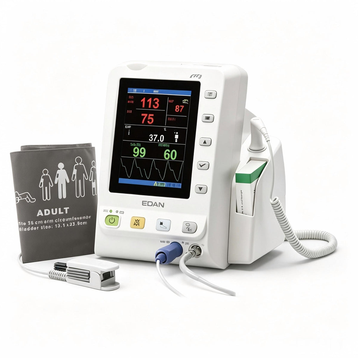 EDAN M3 vital signs monitor with 5.6-inch color display for SpO2, NIBP, and temperature spot checks