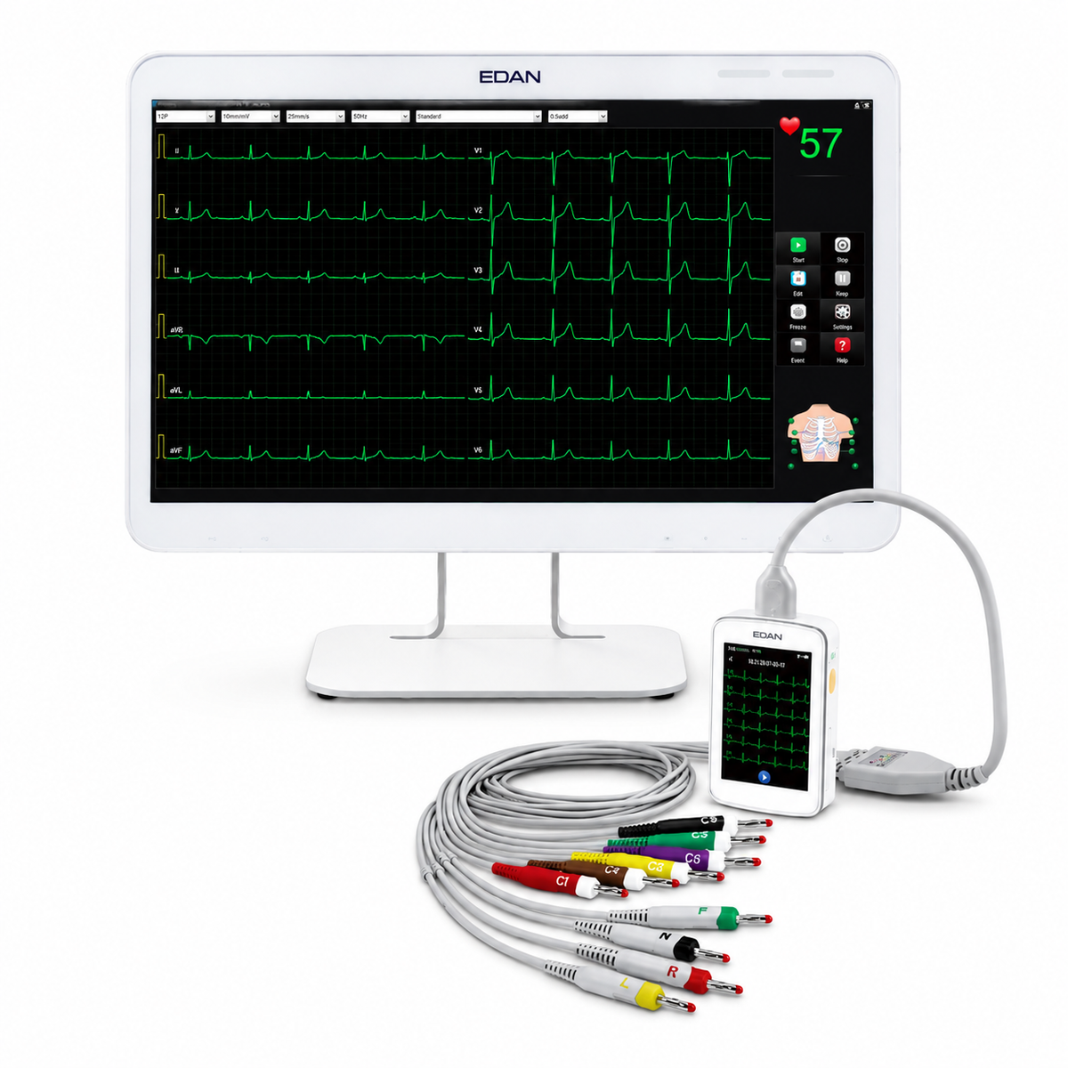 EDAN SE-1515 PC-based ECG workstation with modular 9/12/15/18-lead sampling boxes, wireless DX12 transmitter, stress ECG integration and Glasgow interpretation for hospitals and clinics