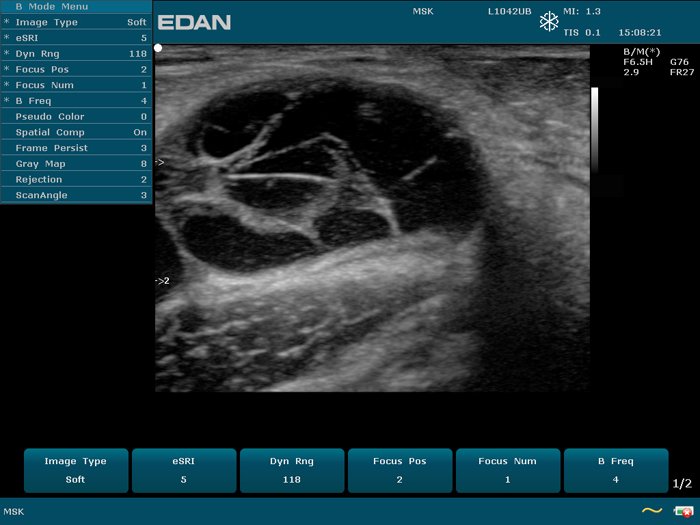 EDAN U50 VET portable veterinary ultrasound system with 12.1-inch display and color Doppler imaging