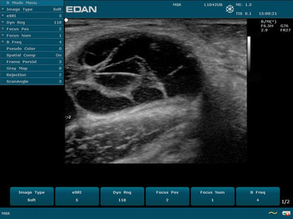 EDAN U50 VET portable veterinary ultrasound system with 12.1-inch display and color Doppler imaging