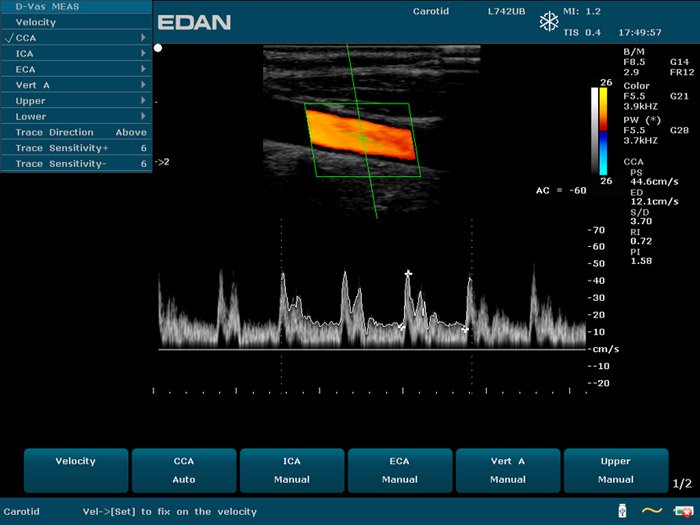 EDAN U50 VET portable veterinary ultrasound system with 12.1-inch display and color Doppler imaging