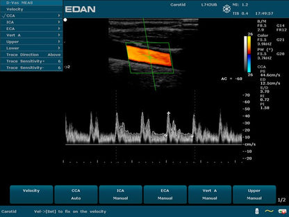 EDAN U50 VET portable veterinary ultrasound system with 12.1-inch display and color Doppler imaging