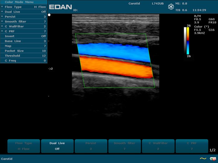 EDAN U50 VET portable veterinary ultrasound system with 12.1-inch display and color Doppler imaging