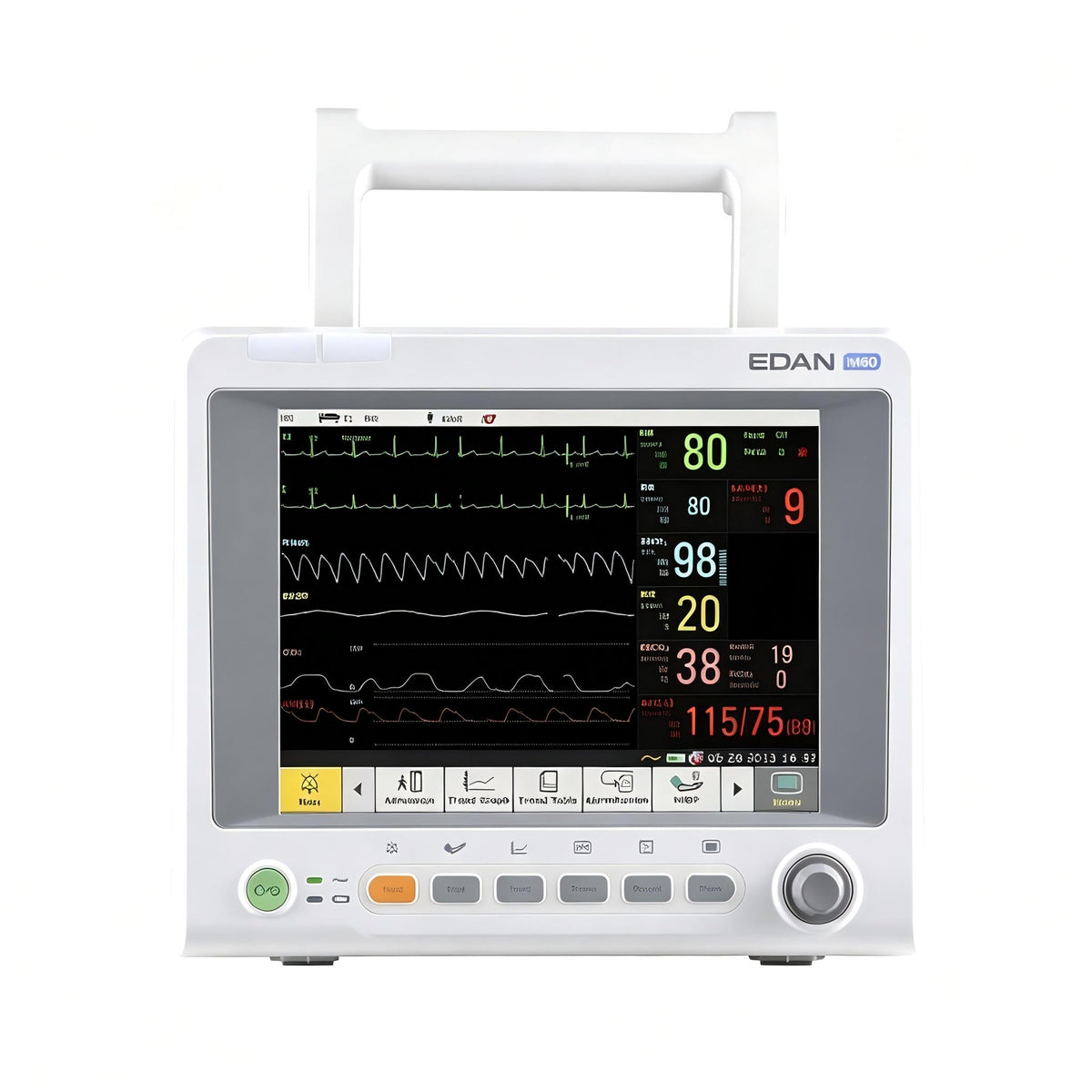 EDAN iM60 multi-parameter patient monitor with 10.4-inch display for bedside monitoring