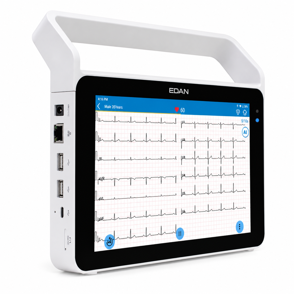 EDAN iSE-1210 12-lead touchscreen electrocardiograph with 10.1-inch LCD, 24-bit acquisition, pacemaker analysis and Wi-Fi connectivity for hospital and clinic ECG
