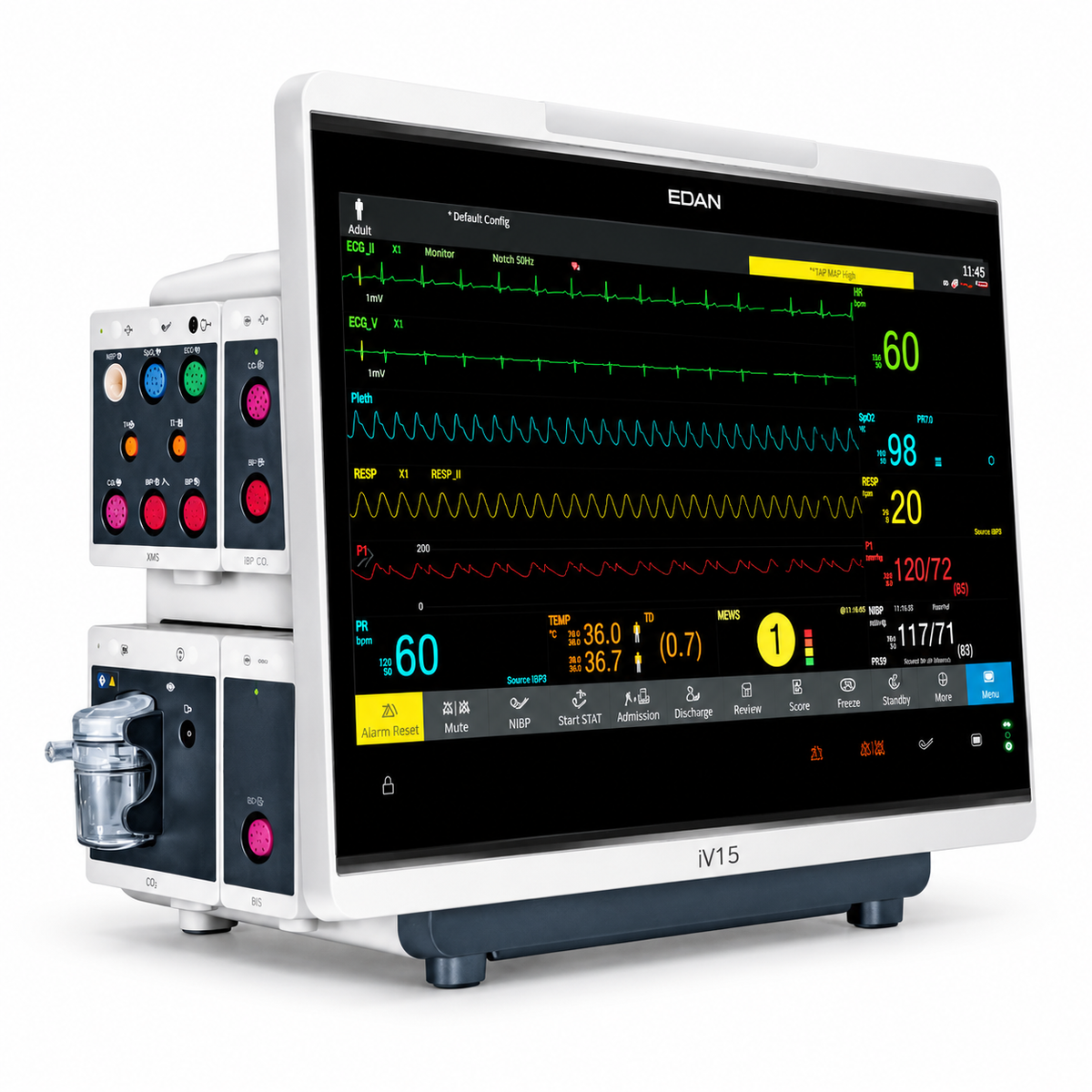 EDAN iV15 15.6-inch Full HD modular patient monitor with detachable transport display, XM5 parameter modules and clinical assistive scoring for ICU and operating rooms