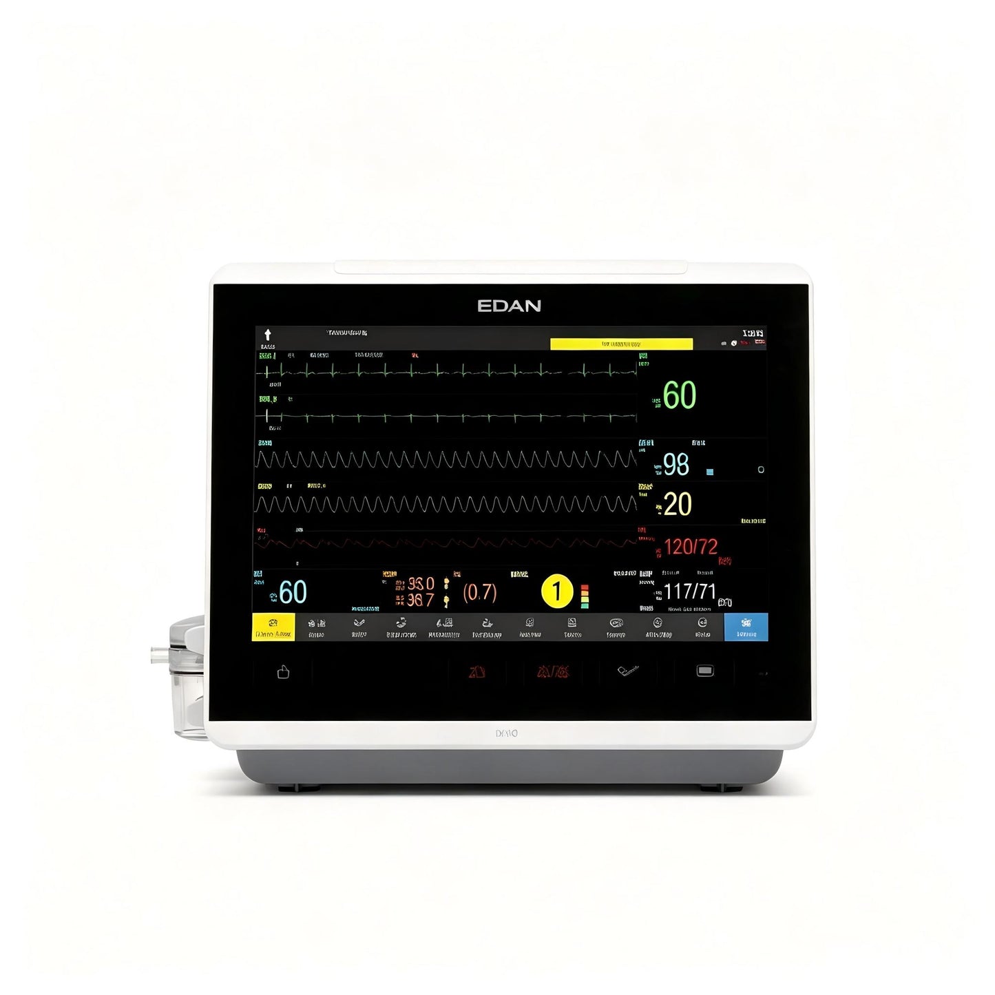 EDAN iX10 multi-parameter patient monitor with 10.1-inch touchscreen for bedside monitoring