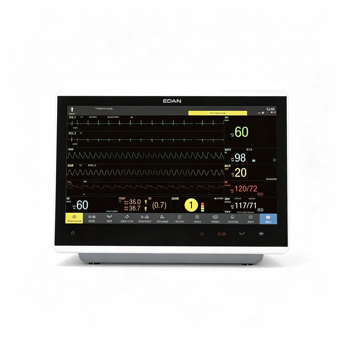 EDAN iX15 multi-parameter patient monitor with 15.6-inch Full HD touchscreen for bedside monitoring