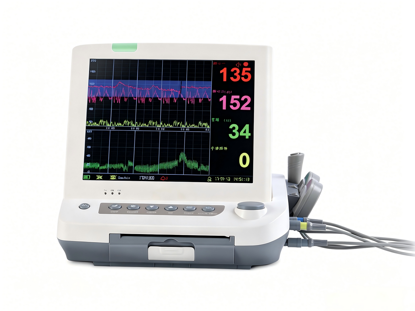 GHM L8P Fetal Monitor – 12.1" Large Display Maternal/Fetal Monitor with Thermal Printer, Auto CTG Scoring, and Twins Monitoring Option #