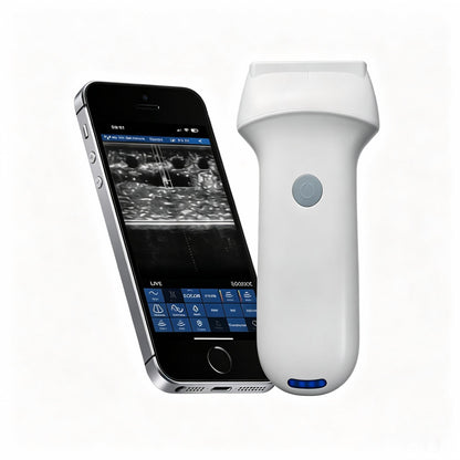 Global Healthcare Medical palm-sized wireless linear color Doppler ultrasound scanner with magnetic navigation for precise needle visualization