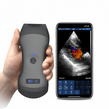 Global Healthcare Medical wireless handheld ultrasound compatible with Android device