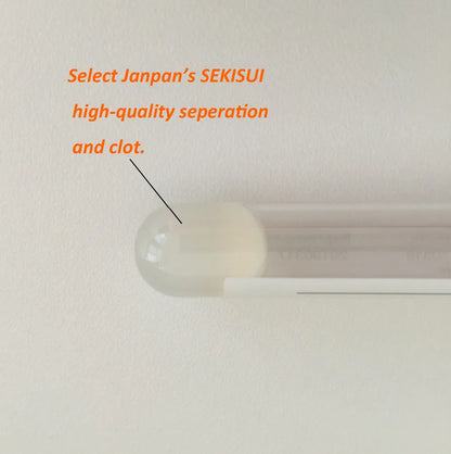 Yellow Top Sterile Separate Gel Clot Activator SST Vacuum Blood Sample Collection Tube for Hospital #