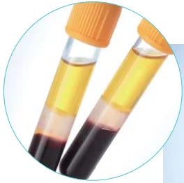 Hospital Medical 4ml Yellow Top Gel & Clot Activator Vacutainer Disposable Sterile Vacuum Blood Collection Tube #