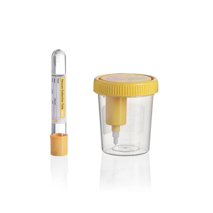 Industry High Quality 100ml Hospital Plastic Vacuum Urine Sample Container With Lids #