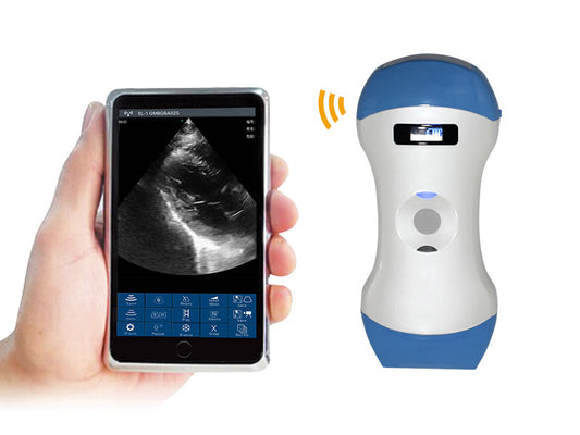 Handheld Wireless Mini Ultrasound Scanner(EXW Price: $1000~$4000)#