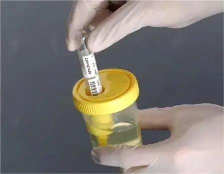 Durable 100ml Transparent Yellow Vacuum Urine Collecting Container for Hospital #