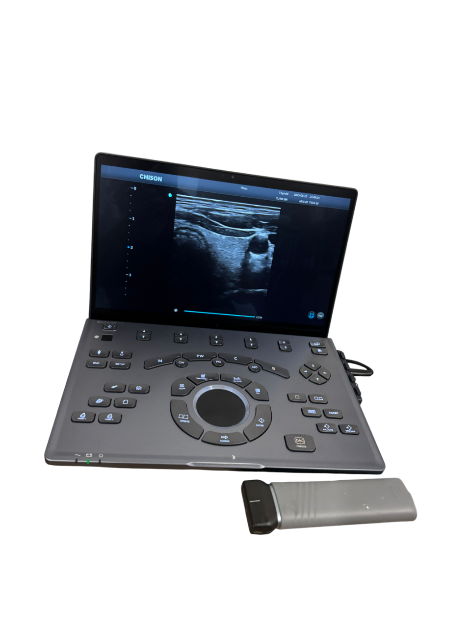 SonoAir Vet Ultrasound #