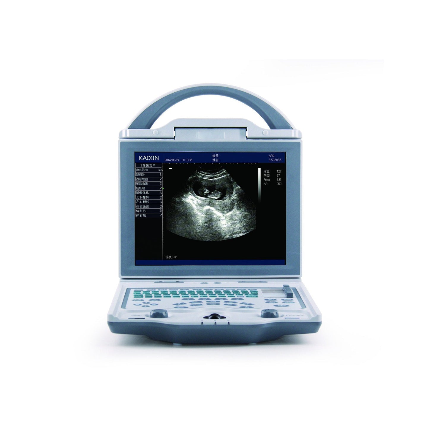 KX5600V Vet Ultrasound #