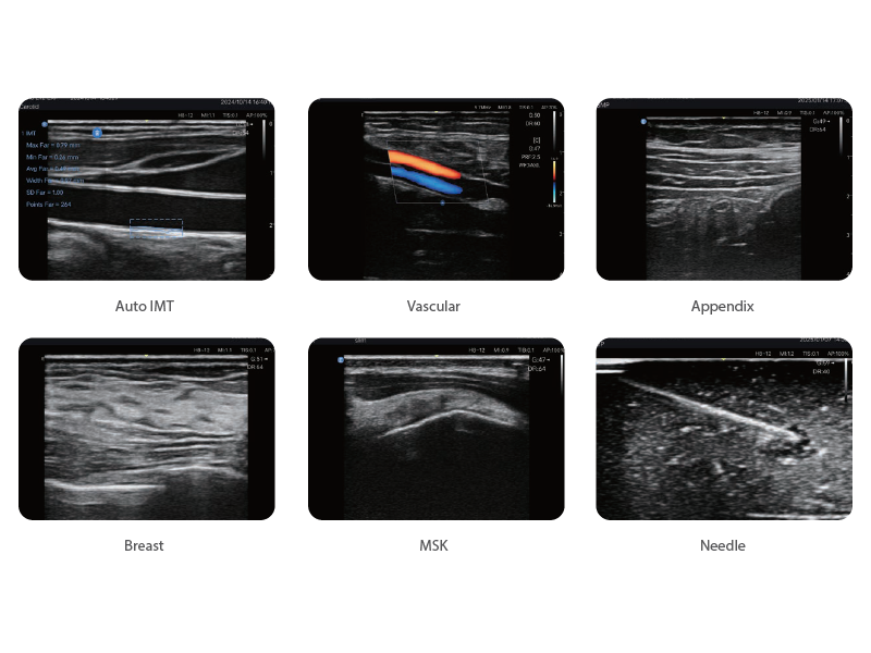 Edan Nano L12 EXP Diagnostic Ultrasound System