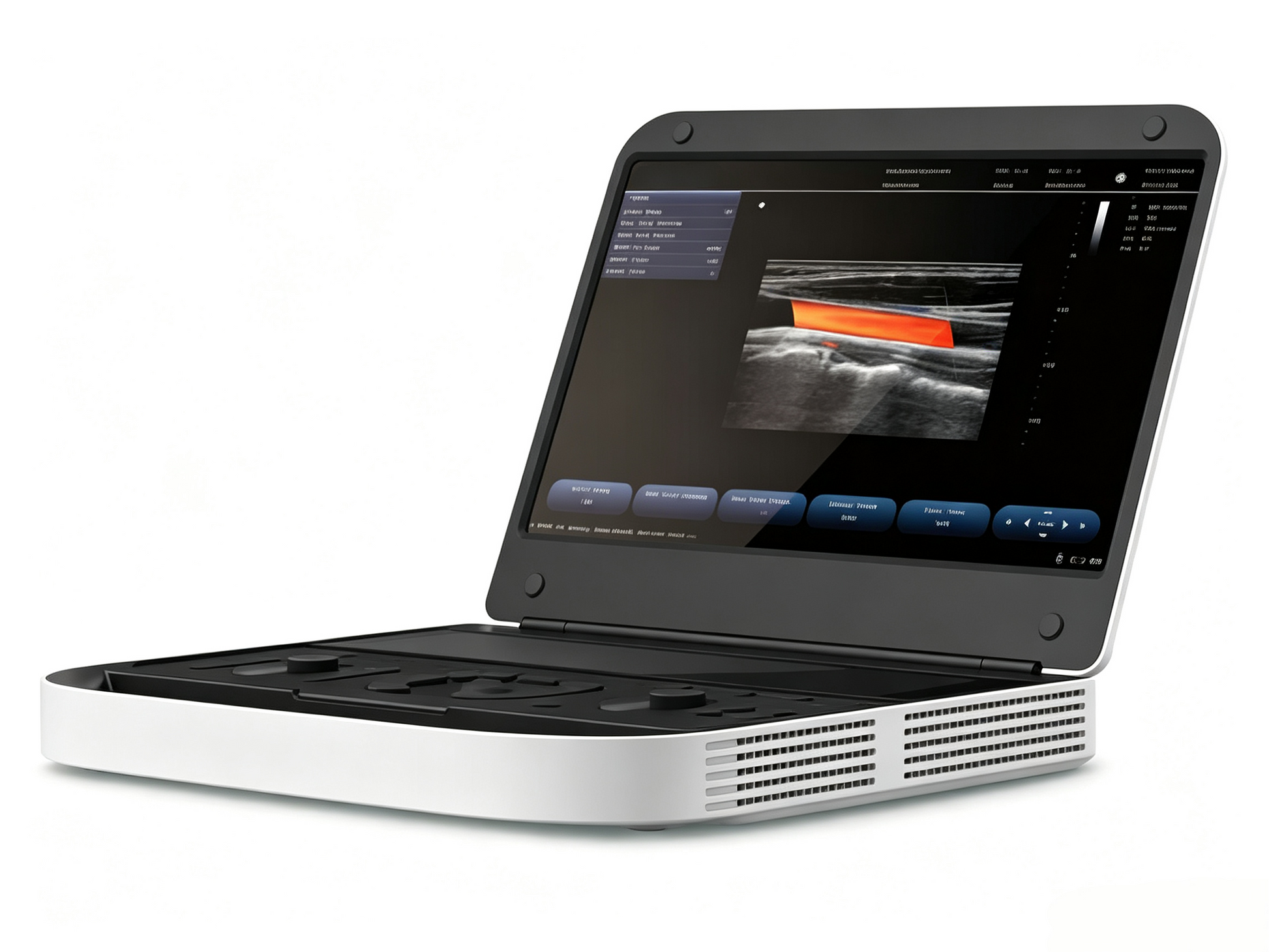GHM-ML151A Premium Diagnostic Ultrasound | High-End Portable Color Doppler System