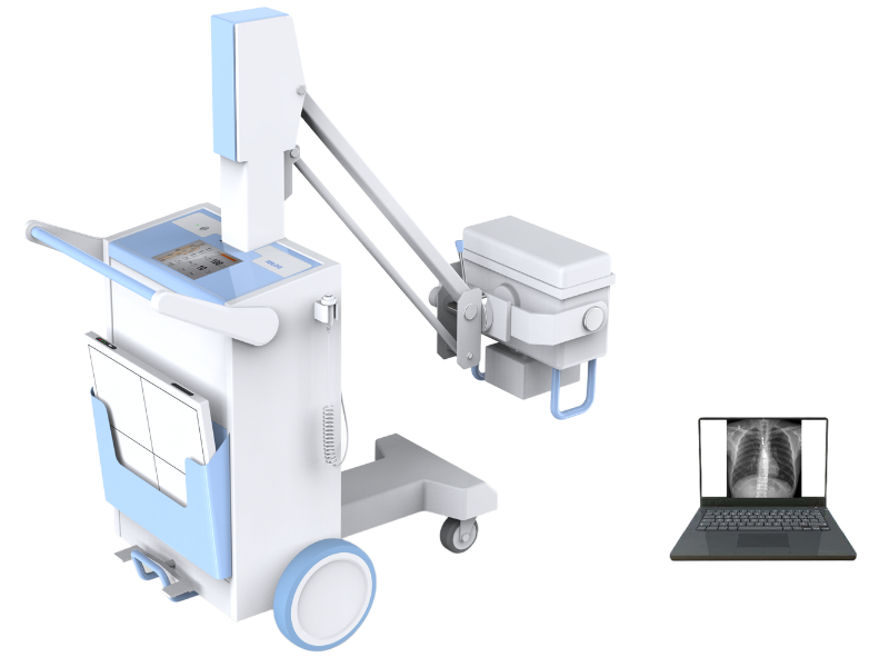 Perlove High Frequency Mobile Digital Radiography System PLX5100 #