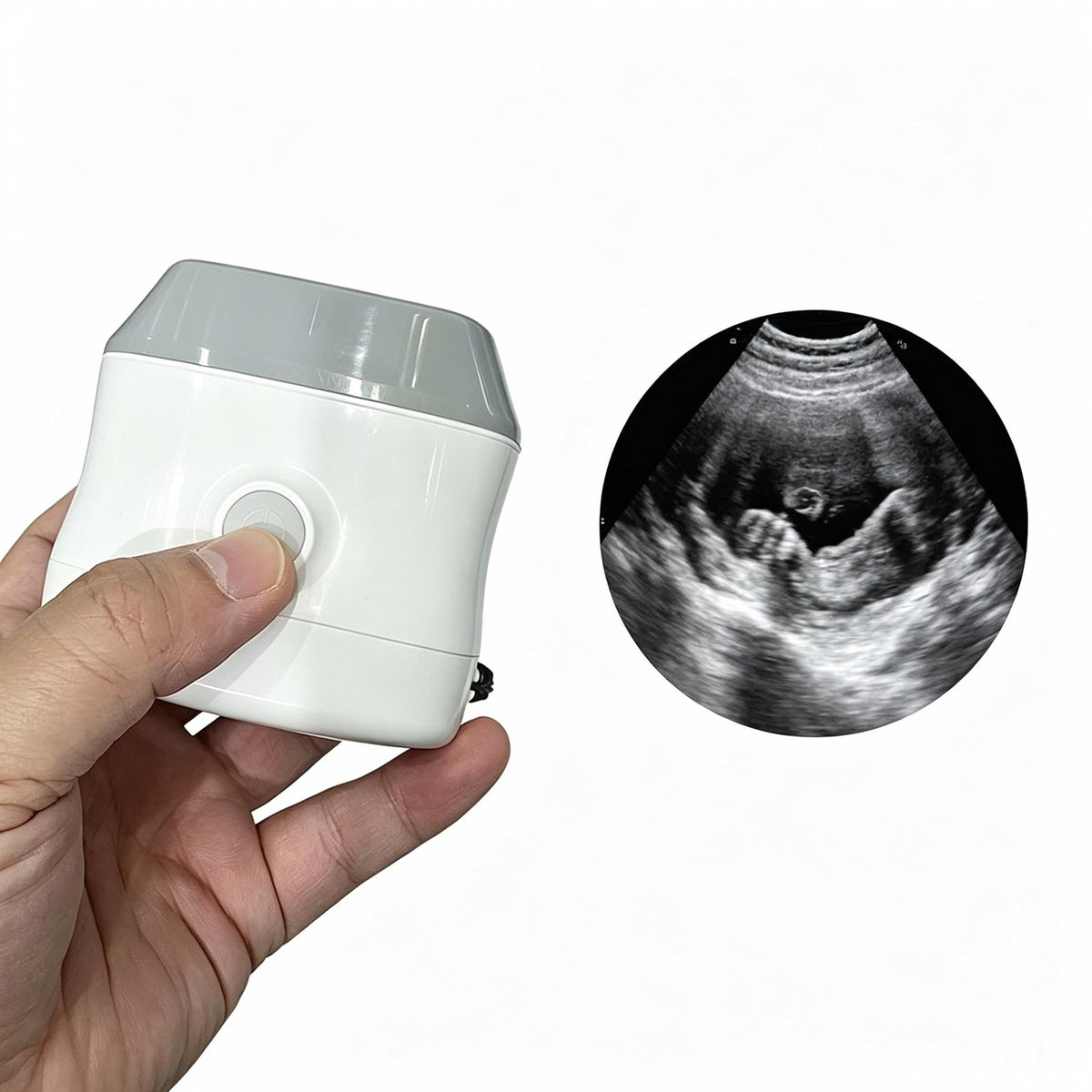 Global Healthcare Medical 4D volume imaging handheld ultrasound system with phased array probe for fetal and cardiac imaging