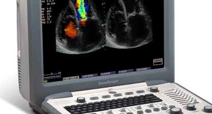 SonoScape S8V Vet Ultrasound #