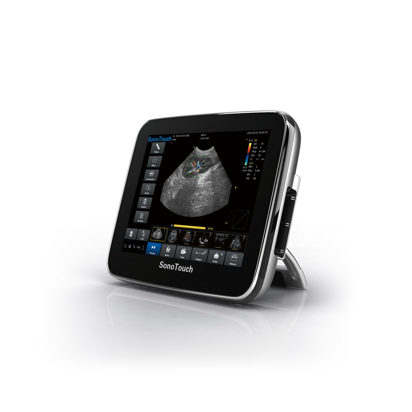 Chison SonoTouch 20 Vet Ultrasound #