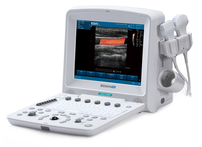 EDAN U50 VET portable veterinary ultrasound system with 12.1-inch display and color Doppler imaging