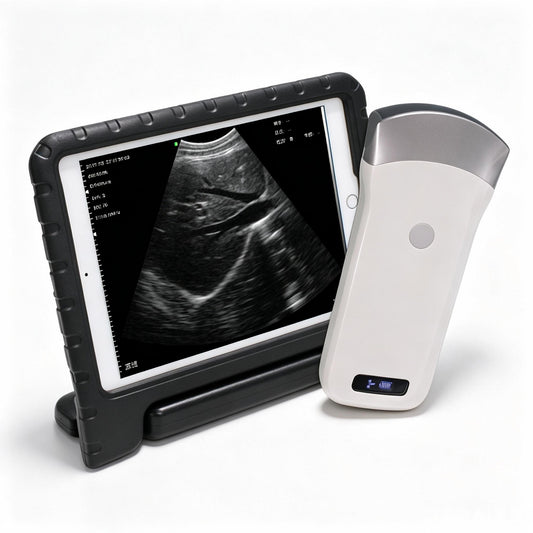 Global Healthcare Medical wireless handheld convex array ultrasound system for abdominal and point-of-care imaging
