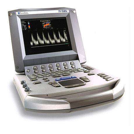 Sonosite Titan Ultrasound #