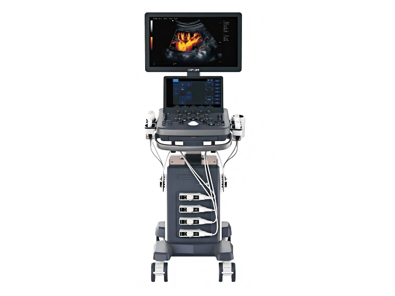 ViV 20 Color Doppler Ultrasound System