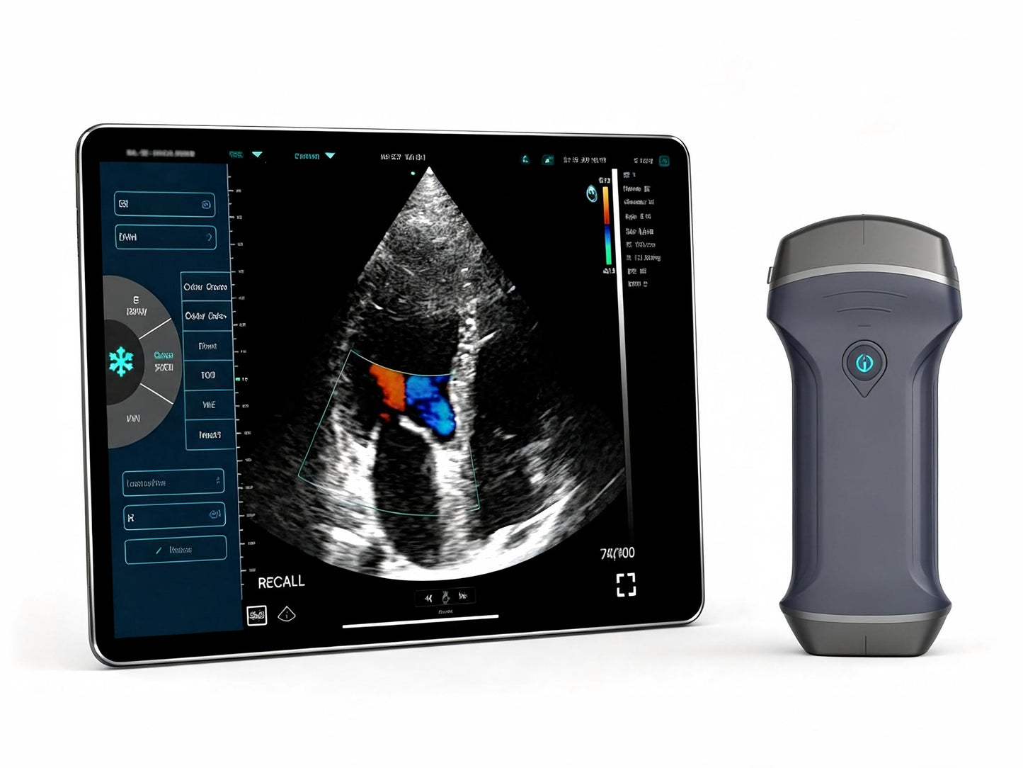 Global Healthcare Medical 3‑in‑1 Wireless Color Doppler Ultrasound – Dual‑Head Convex + Linear Probe with WiFi & USB