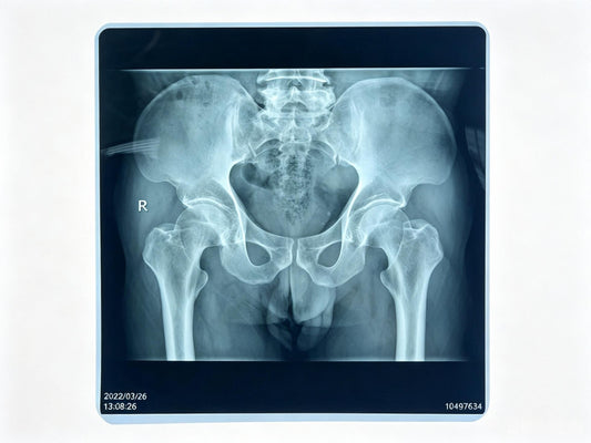 X-ray Film Medical Dry Film Thermal – High-Quality Direct Thermal Imaging Film for Diagnostic Radiology