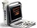 SonoScape A6 Ultrasound #